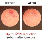 SANUO® Black Rice Еxfoliating Ampoule